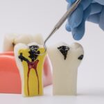 Próchnica kwitnąca