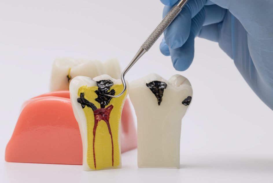 Próchnica kwitnąca